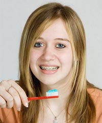 stock photo of a teen girl with braces brushing her teeth